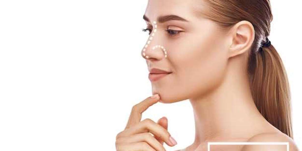 Transformative Benefits of Rhinoplasty: More Than Just Aesthetic Enhancement