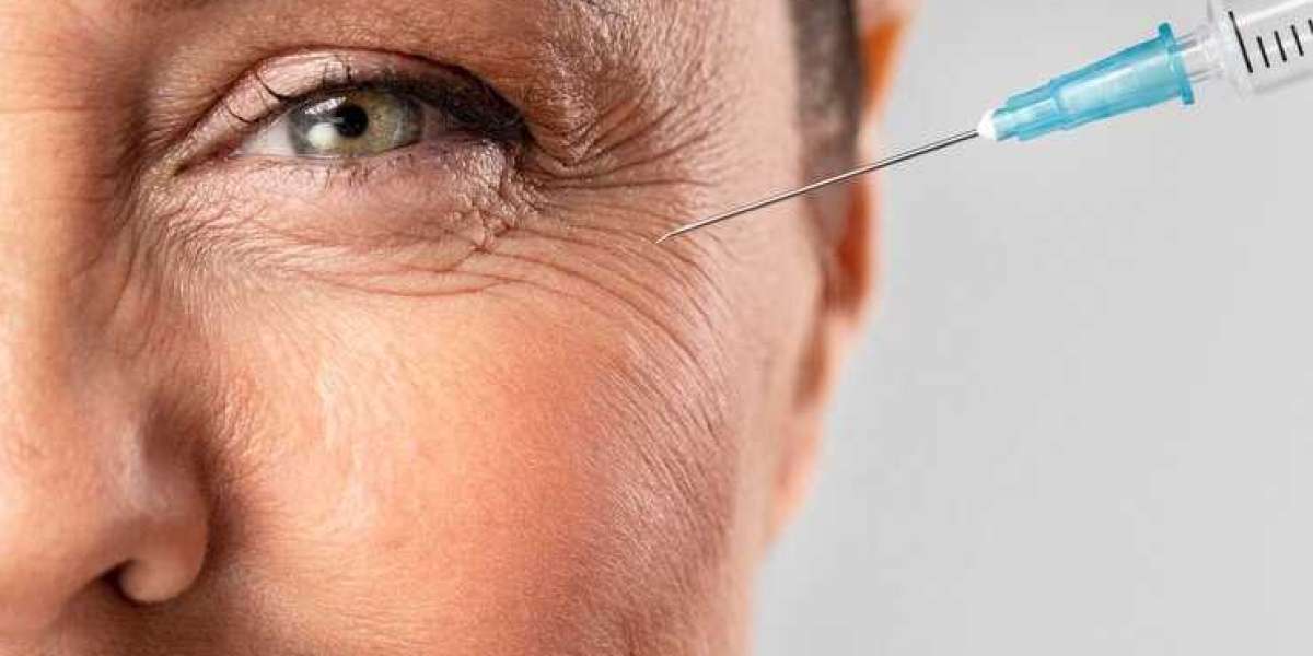 How Long Does Botox Take to Work?