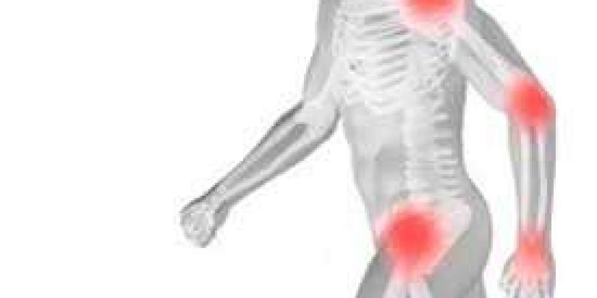 Flexura D for Muscle Spasms: Effective Relief Strategies