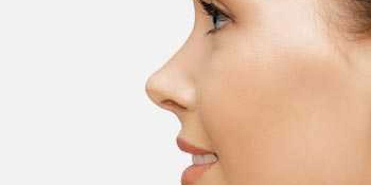 Is Rhinoplasty the Best Option for a Sleeker Nose?